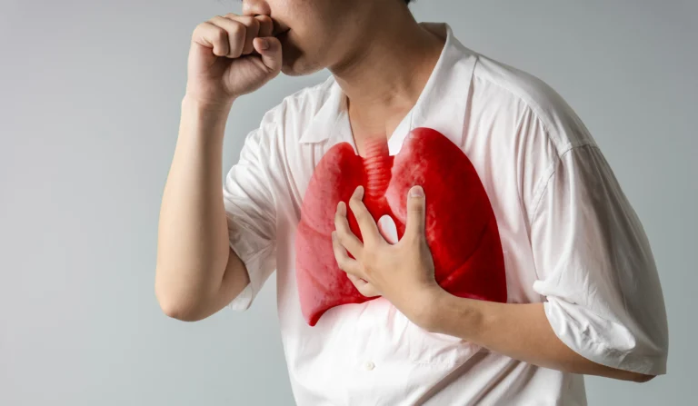 Non‑Small Cell Lung Cancer ICD‑10 Codes & NSCLC Guide 2025