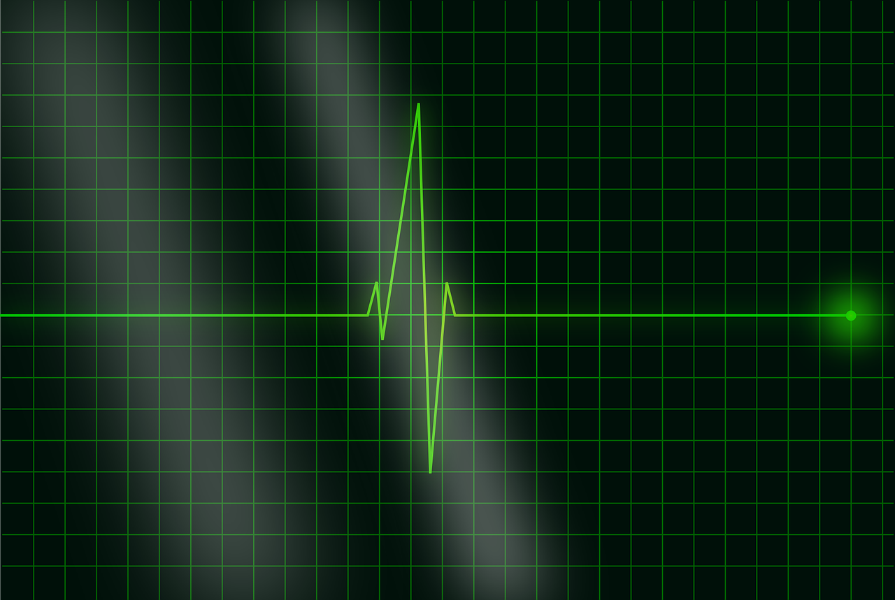 ECG Findings in Anterolateral Infarct